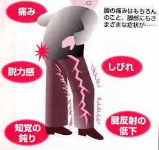 脊柱管狭窄症2